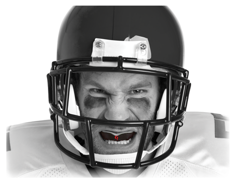 Custom mouthguard