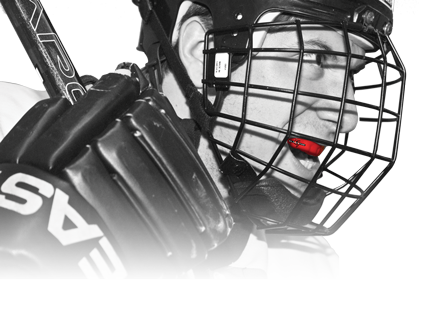Custom Mouthguards