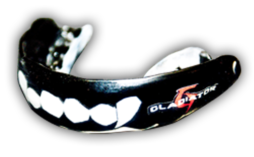 custom mouthguard