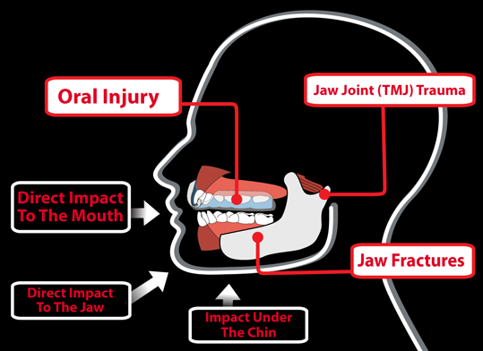 oral protection